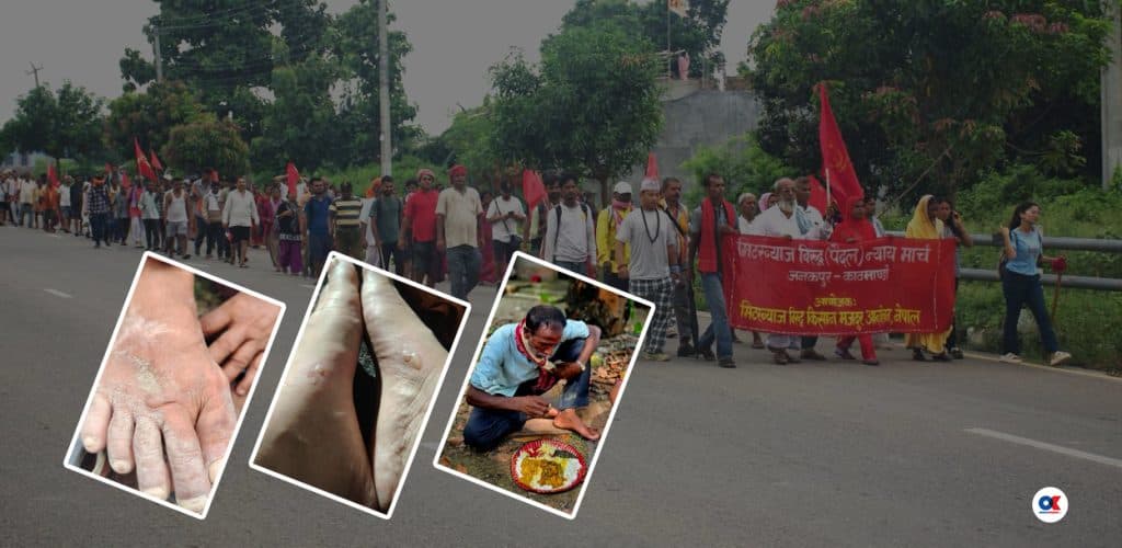 मिटरब्याज पीडितको मार्चपास : दैनिक २० किलोमिटर हिँडाइ, सुन्निन थाले पैताला